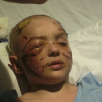 Frankie Injury Photo